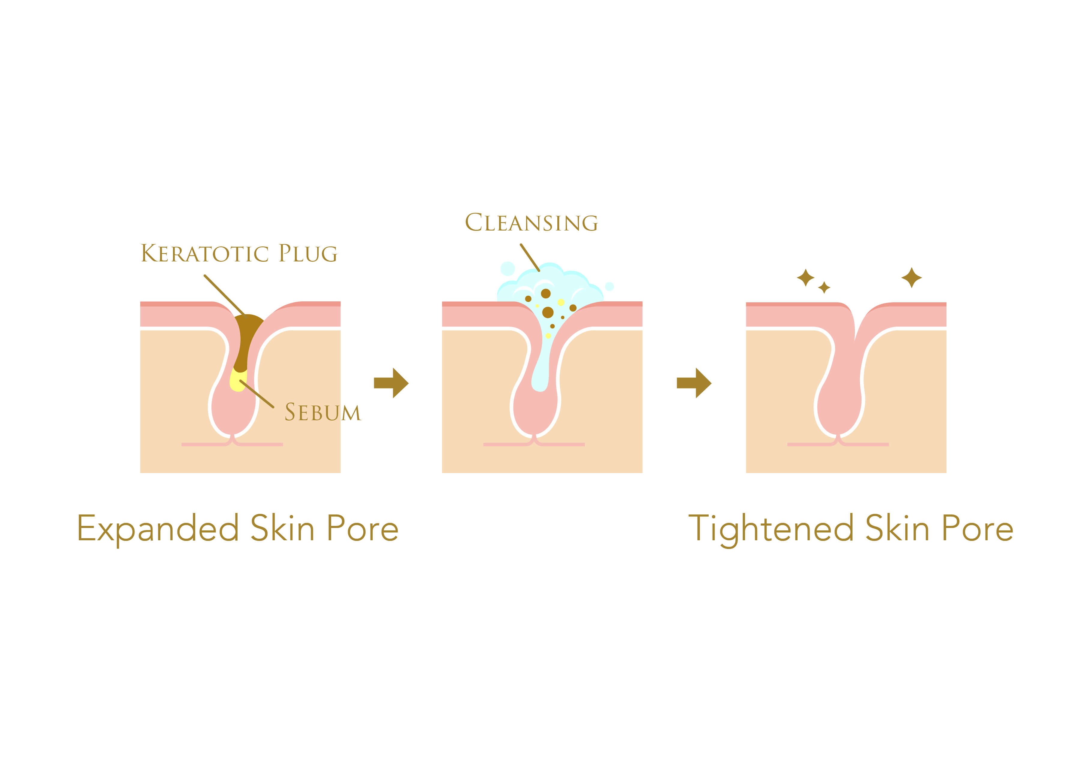 Infographic on cleansing out skin pore