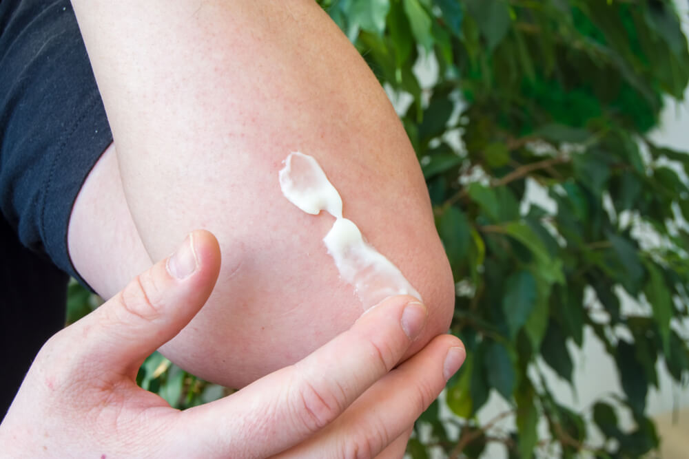 Topical antibiotic cream on elbow